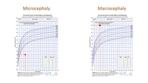 Image result for Normal Head Size