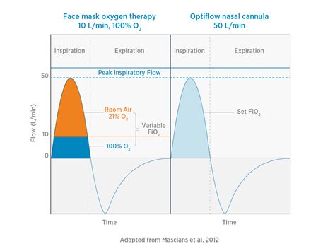 Image result for O2 Optiflow