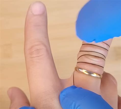 Image result for Ring Removal String