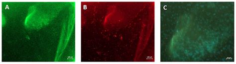 Eco-Friendly Production of Polyvinyl Alcohol/Carboxymethyl Cellulose ...