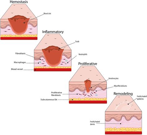 Wound Healing Skin