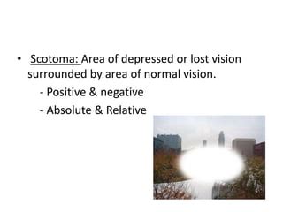 Image result for Visual Deficit Chart