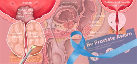 Prostate Anatomy Diagram