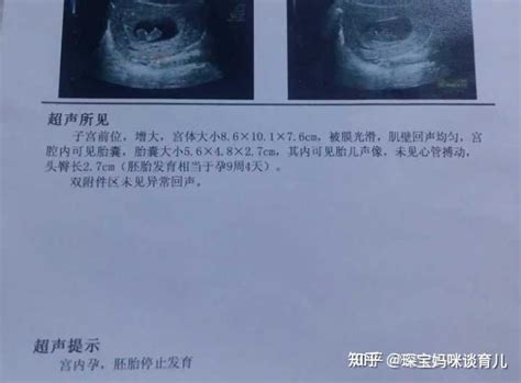 胚胎形成“时间轴”：怀孕几周可以看到孕囊、胎心胎芽？孕妈收藏_腾讯新闻