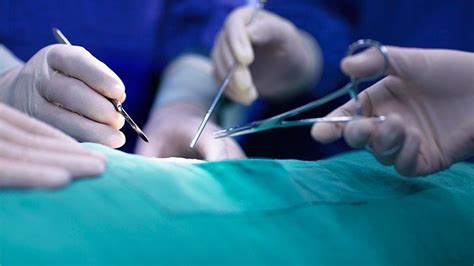 What Is an Appendectomy? Surgery and Recovery