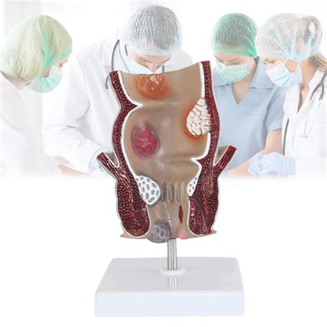 Healthy Human Anus Should Look Like