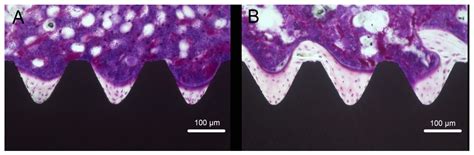 Optimized Surface Characteristics and Enhanced in Vivo Osseointegration ...