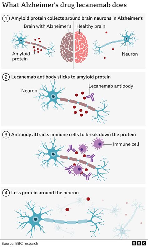 Alzheimer's drug lecanemab hailed as momentous breakthrough - BBC News