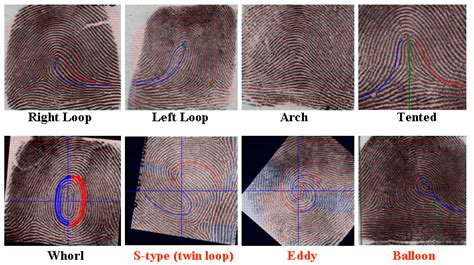 Types Of Whorl Fingerprints