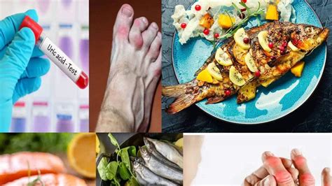Fish to cure Uric Acid & Gout: বাজারে ‘তুমুল সস্তা’ এই ‘৫ মাছ’ খেলেই ...