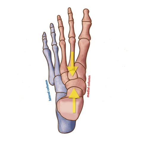 Lateral Column Overload - Masterton Foot Clinic