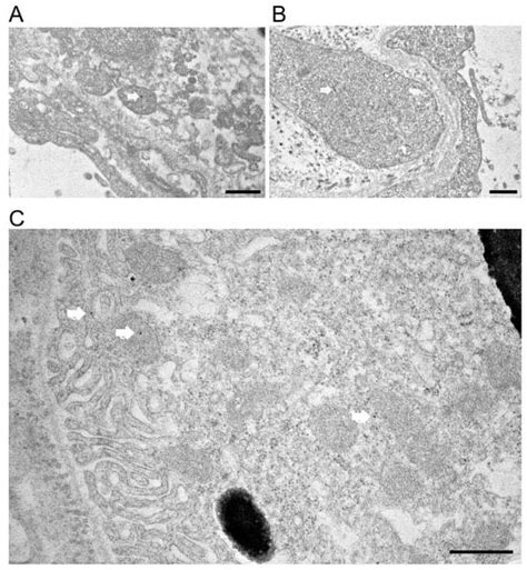 Prominin-1 Knockdown Causes RPE Degeneration in a Mouse Model