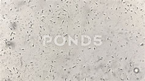 Human Sperm Under Microscope