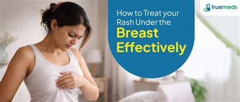 Skin Infections Information and Treatment Guidance