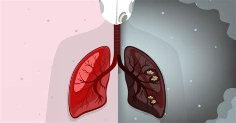 Shield Yourself From Deadly Effects Of Air Pollution – Setu Nutrition