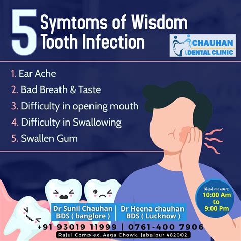 Do you know about wisdom teeth – Artofit