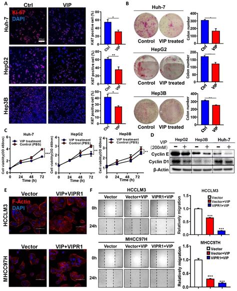 Image result for C ViPR