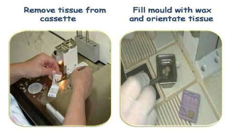 Image result for Tissue Sample Receiving