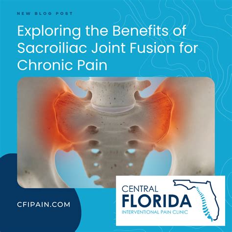 Exploring the Benefits of Sacroiliac Joint Fusion for Chronic Pain - CFIPain.com