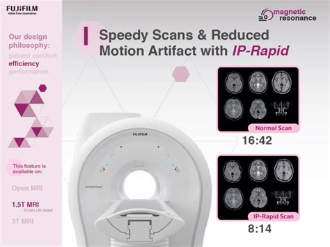 Image result for Fuji Dynamic Visualization