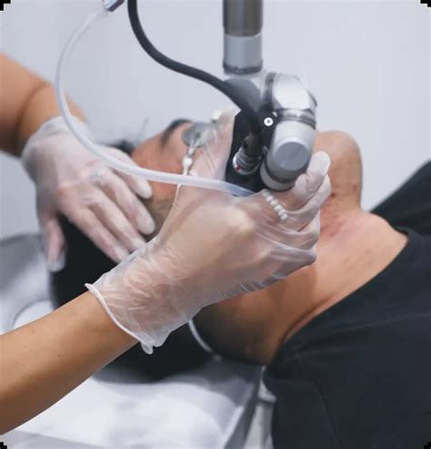 Image result for Derma Procedure