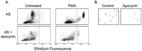 IJMS | Special Issue : Oxidative Stress in Cardiovascular Disease