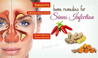 Image result for Sinus Infection Remedies