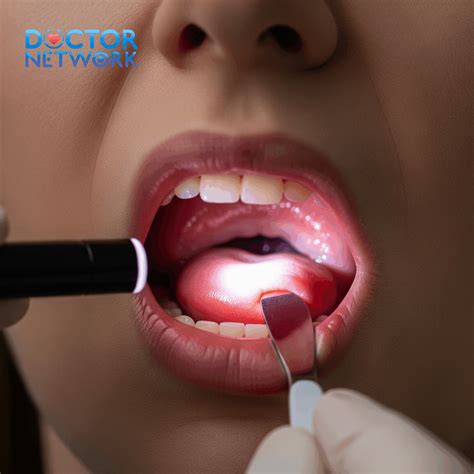 Why Do People Get Their Tonsils Removed? Common Reasons Explained - Doctor Network