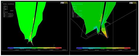 Endodontic Dentistry: Analysis of Dentinal Stress and Strain ...