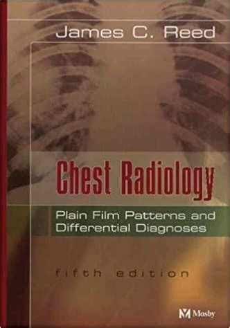 Chest Radiology - Plain Film Patterns And Differential Diagnoses ...