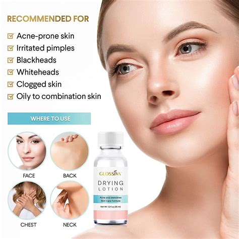 Glossiva Drying Lotion - Overnight Acne Spot Treatment for Pimples ...
