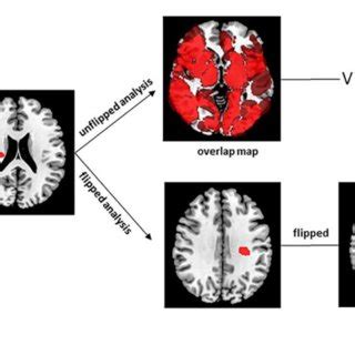 Image result for VLSM Process