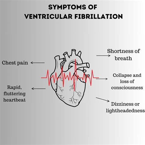 Ventricular fibrillation: Causes, Risk Factors, Symptoms, Treatment