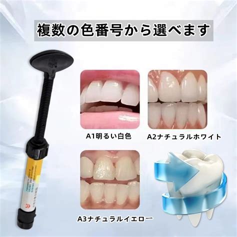 ヘアリプロスカルプ Dental Resin Tooth Filling Material Tooth Repair Kit India | Ubuy