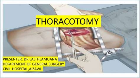 Image result for Open Chest Thoracotomy