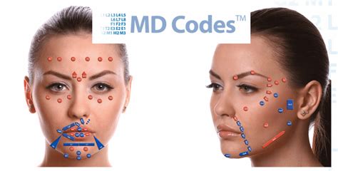 MD Codes (МД коды) как пошаговая инструкция по контурной пластике лица ...