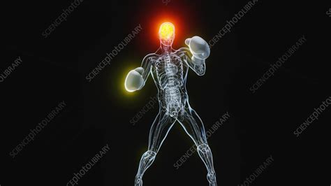 Image result for Boxer Engine Animation