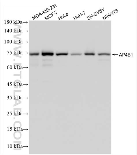 AP4B1 antibody (84710-3-RR) | Proteintech