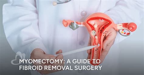 Myomectomy: a Guide to Fibroid Removal Surgery | Thomson Medical