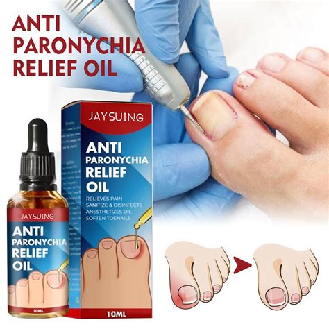 2023 Best German Toenailplus NailProp Anti | Ubuy India