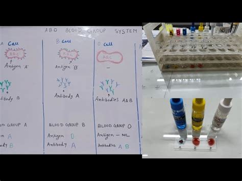 Blood Group Test Kit - Pro TechEx - ABO Blood Grouping With Rh-Factor ...