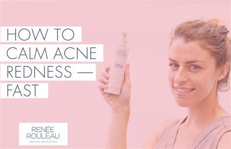 Reduce Redness From Acne Using Five Skincare Ingredients