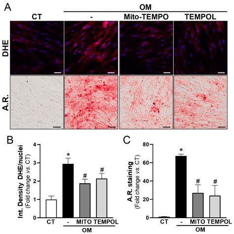 Lysyl Oxidase in Ectopic Cardiovascular Calcification: Role of ...