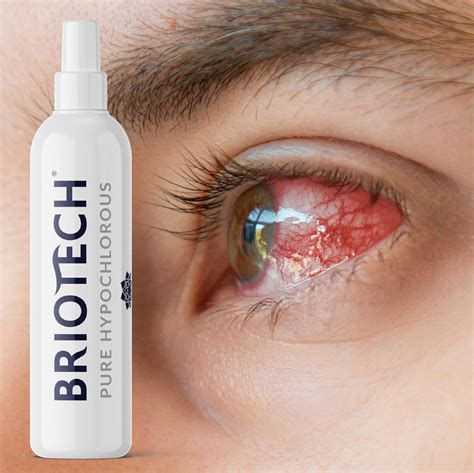 Buy BRIOTECH Pure Hypochlorous, an All Natural Multi-Purpose HOCl ...