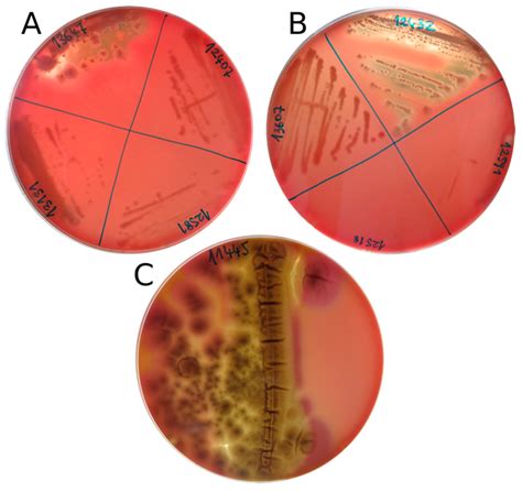 Bacteria Hemolysis Blood Agar at Isabel Kleeman blog