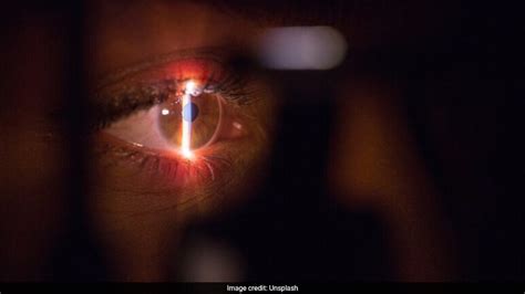चेहरे पर बैठी मक्खी को मारना पड़ा महंगा, डॉक्टरों को निकालनी पड़ गई आंख ...