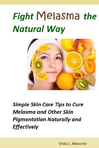 Fight Melasma the Natural Way- Simple Skin Care Tips to Cure Melasma ...