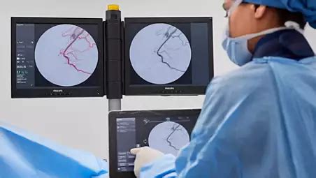 Philips - Zenition 90 - Mobile C-arm with flat detector