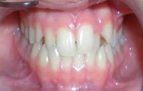 Smile Arc Treatments available in smile arc dental vijayawada