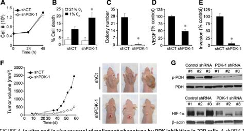 Image result for Genetic Inheritance of Pyruvate Dehydrogenase Complex